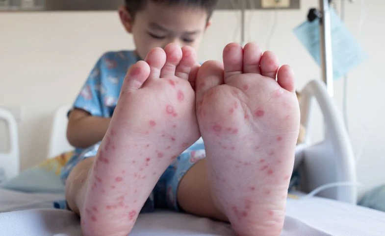 Lab Viroxy : BerryC Sanitiser Teruji Lab Basmi Human Foot Mouth Disease HFMD Flu Singapore